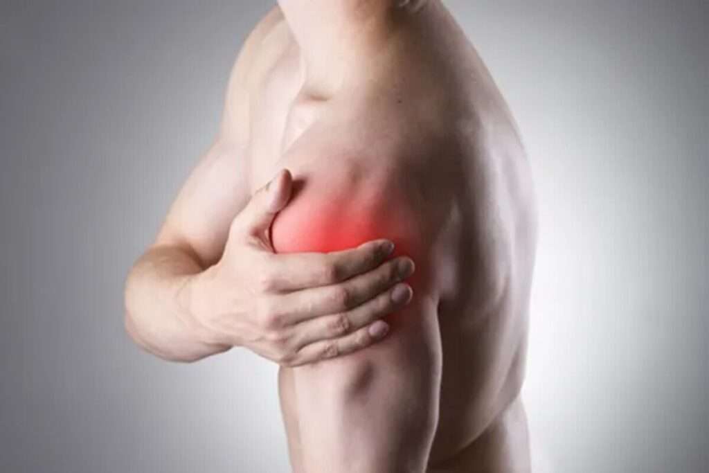 Overcoming Biceps Tendinitis of the Shoulder