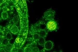 Russia’s New mRNA Cancer Vaccine Launching in 2025 – A Breakthrough in Cancer Treatment