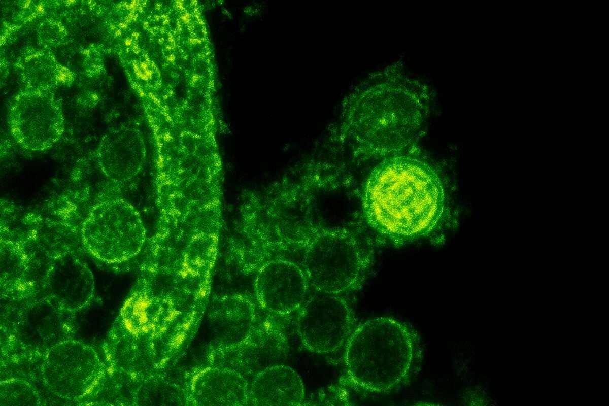 Russia’s New mRNA Cancer Vaccine Launching in 2025 – A Breakthrough in Cancer Treatment